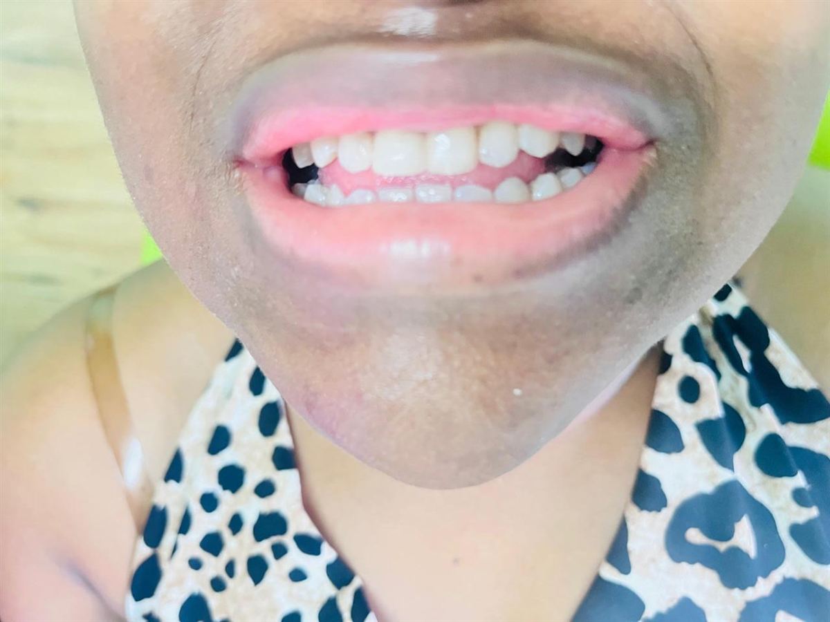 Smiling patient after treatment at MV Nzama Dental